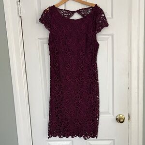 Alice + Olivia Lace Dress with open back